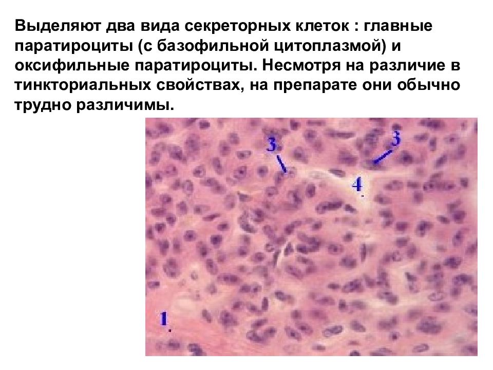 Клетка с базофильной цитоплазмой. Паратироциты паращитовидной железы. Оксифильные паратироциты функция. Главные и оксифильные паратироциты. Главные и оксифильные клетки.