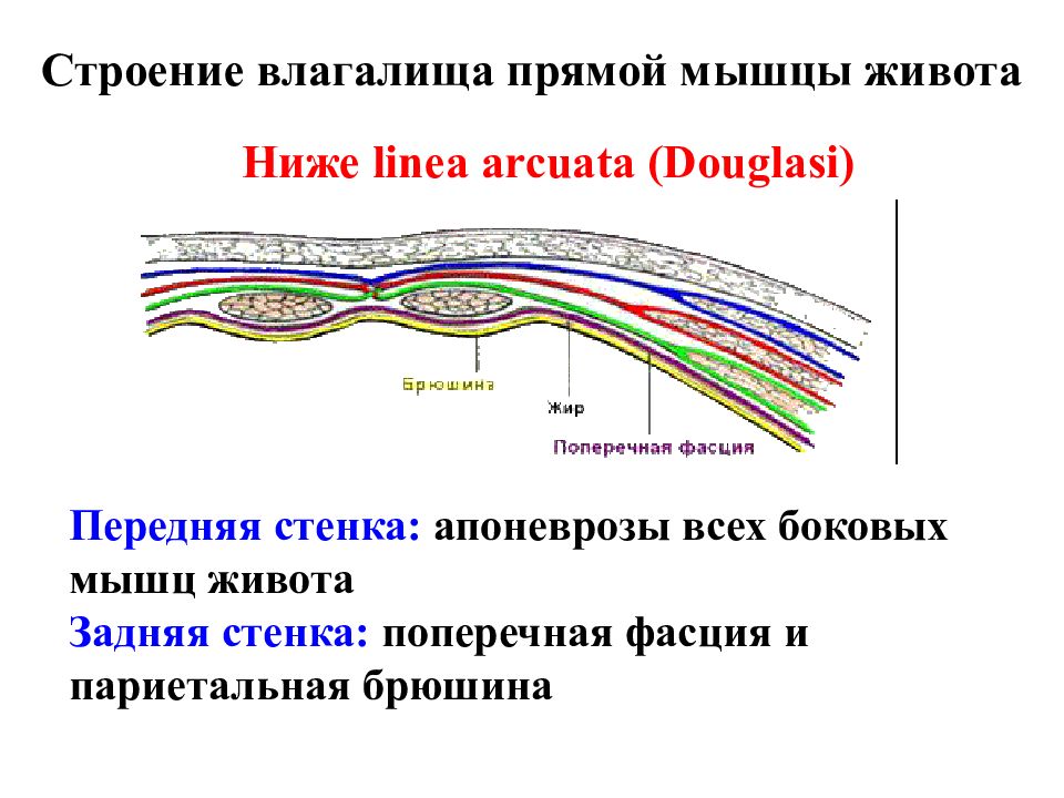 Поперечный распил передней брюшной стенки выше и ниже пупка схема