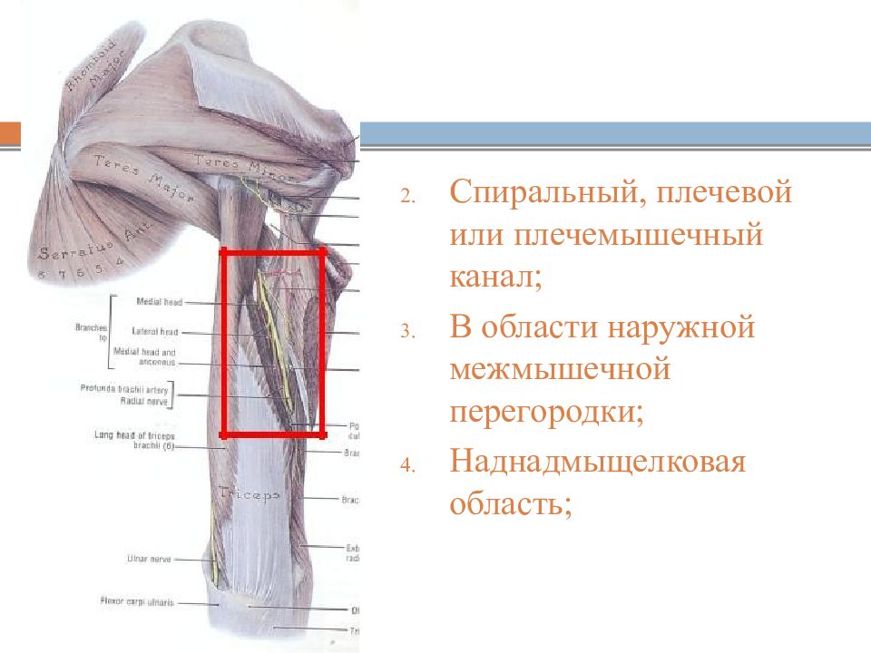 Трехстороннее и четырехстороннее отверстие