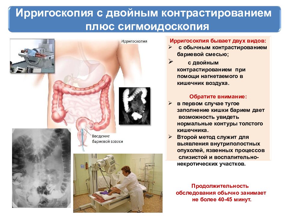 Ирригоскопия кишечника что это и как делают