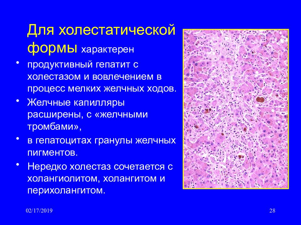 Холестаз смешанного типа микропрепарат рисунок