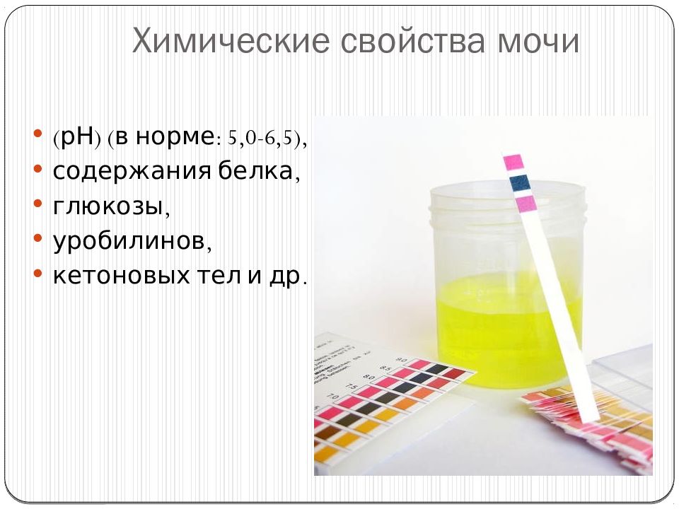 Химические свойства мочи. Физико химическое исследование мочи. Химическое исследование мочи белок. Исследование мочи: химические свойства.