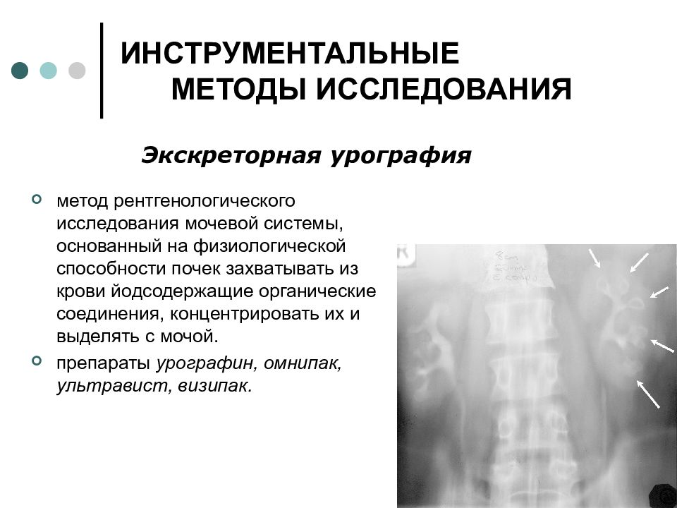 Инструментальные методы исследования. Инструментальные исследования почек. Инструментальные методы обследования почек. Инструментальные методы исследования мочевыделительной. Методы исследования мочевой системы.