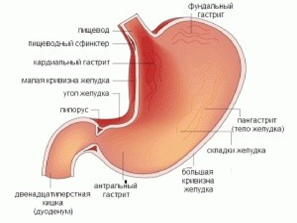 Антрум гастрит. Отделы желудка фундальный отдел. Антральный отдел желудка гастрит. Антральный и фундальный гастрит. Антральный и фундальный отдел желудка.