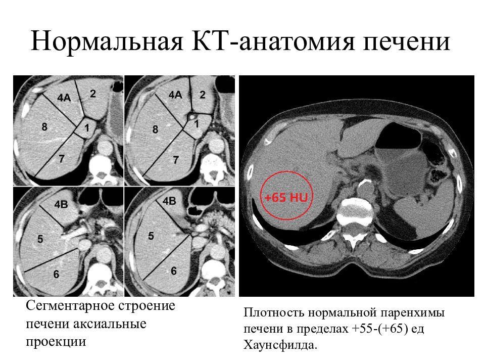 Кт анатомия печени