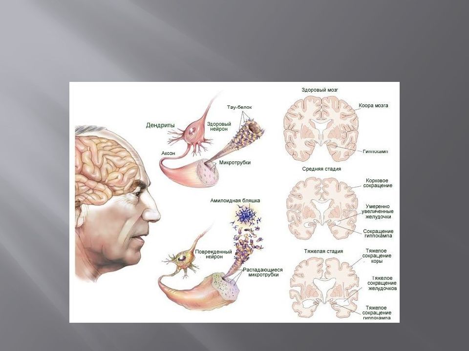 Neurotrauma. Нейротравма и ишемический Каскад.