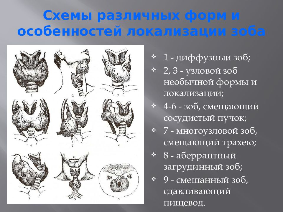 Презентация на тему заболевания щитовидной железы