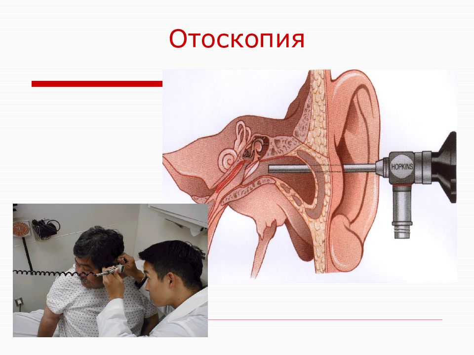 Осмотр ушной раковины