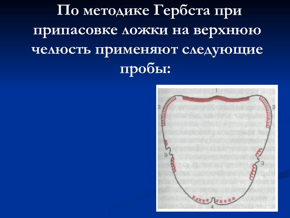 Функциональные пробы Гербста на верхней челюсти. Индивидуальная ложка пробы Гербста. Функциональные пробы по Гербсту для верхней челюсти. Функциональные пробы в ортопедической стоматологии.