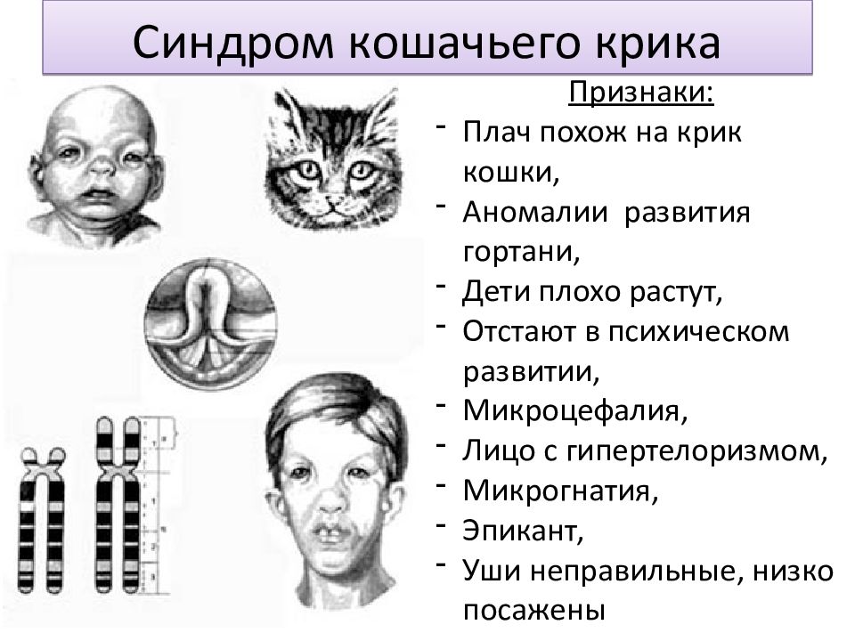 Каким номером на рисунке обозначен тип мутации характерный для больных с синдромом кошачьего крика