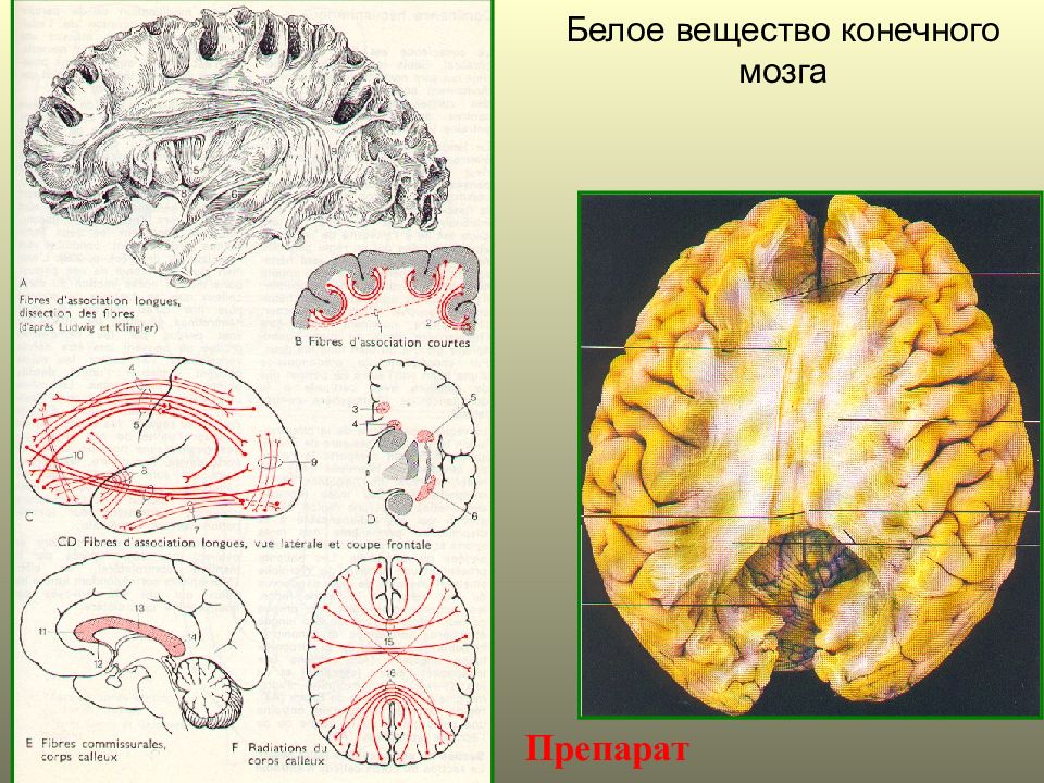 Конечные вещества. Функции белого вещества конечного мозга. Проекционные волокна белого вещества конечного мозга. Конечный мозг серое и белое вещество. Белое вещество конечного мозга анатомия.