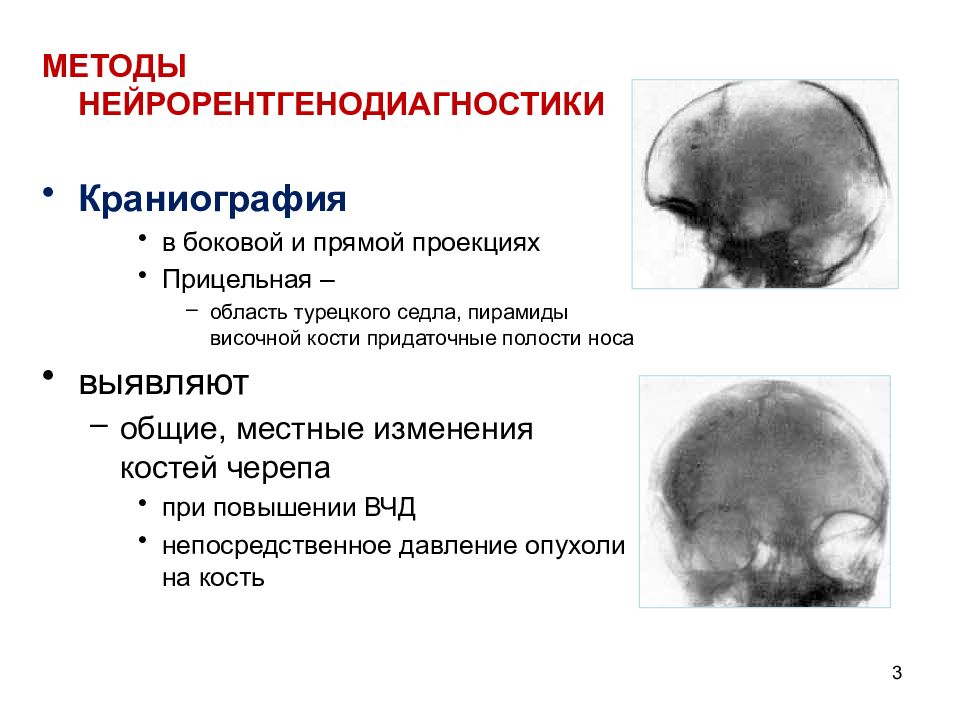 укладка черепа в боковой проекции
