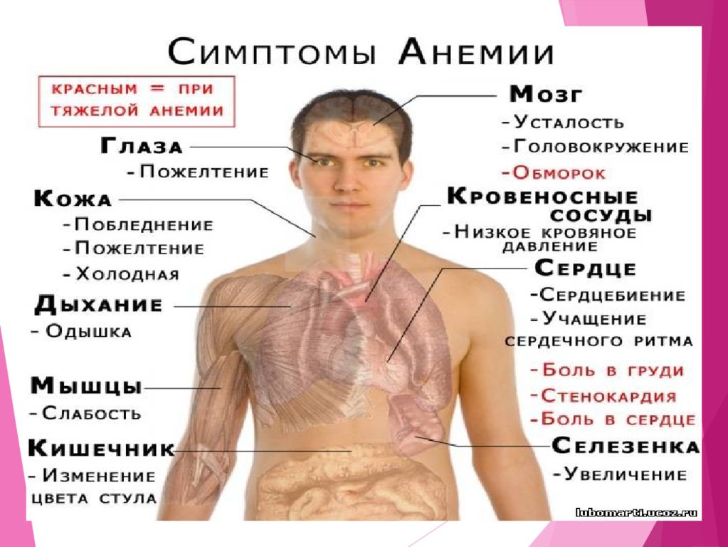 Синдром изменения крови. Анемия симптомы и последствия.