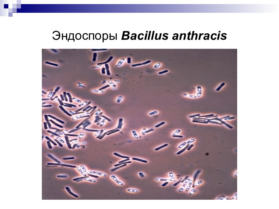 Презентация по микробиологии сибирская язва