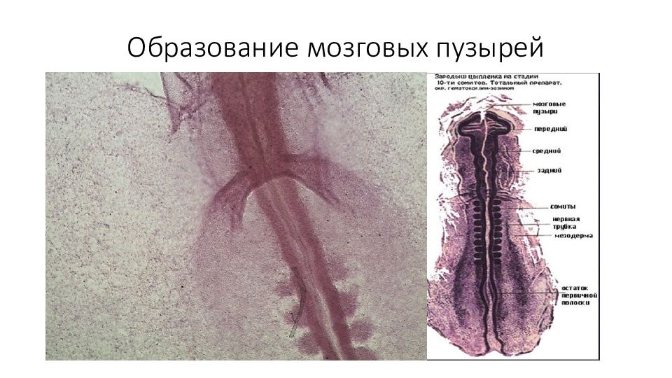 Образование головного мозга