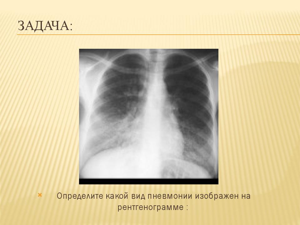 Изображение органов на рентгенограммах является ответ на тест