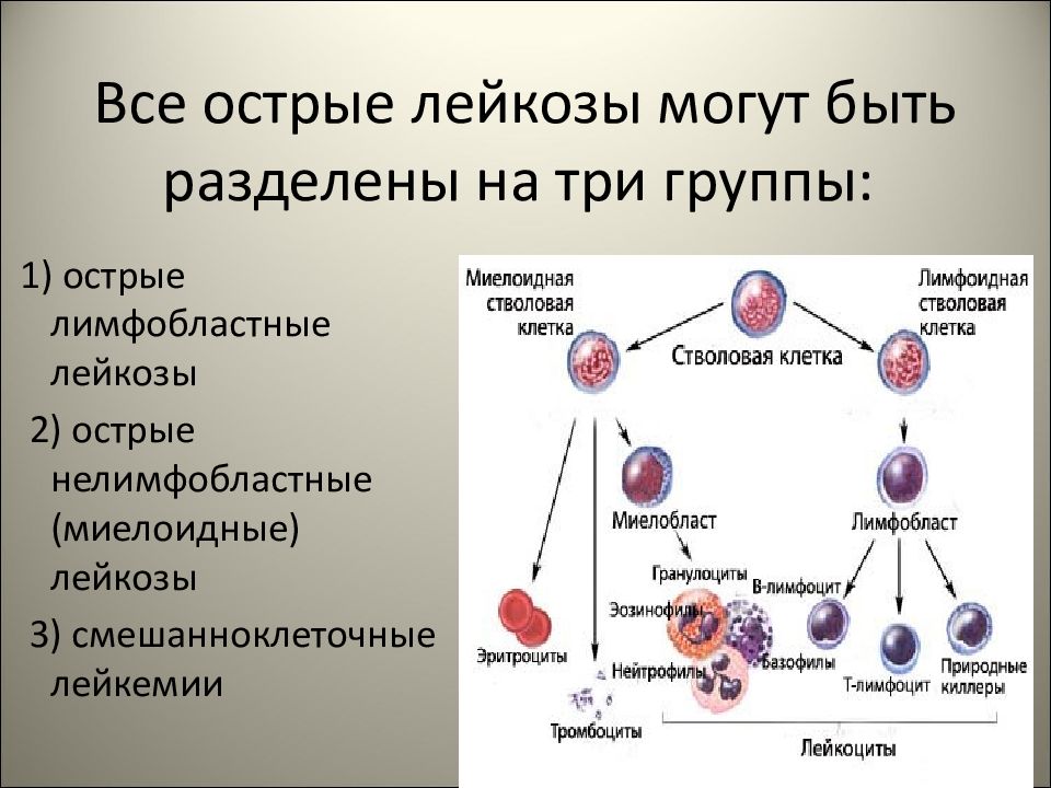 Острый миелоидный лейкоз прогноз. Лимфобластный лейкоз в2 клеточный. Острый миелоидный лейкоз классификация. Классификация острых лейкозов.