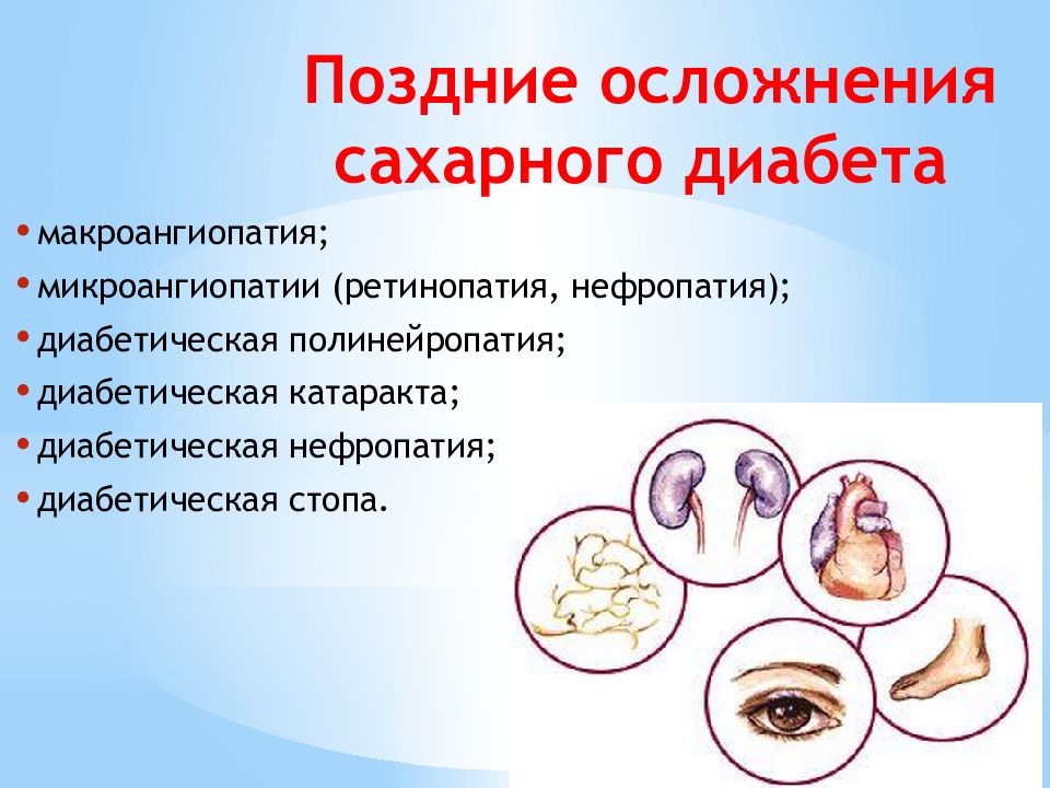 Осложнения сахарного диабета картинки для презентации