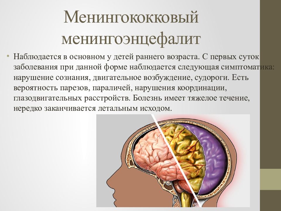 Менингоэнцефалит этиология. Серозный менингоэнцефалит. Менингококковый менингоэнцефалит. Симптомы менингоэнцефалита. Вирусный менингоэнцефалит.