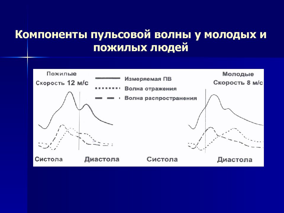 Сосудистая стенка вне пульсовой волны не пальпируется