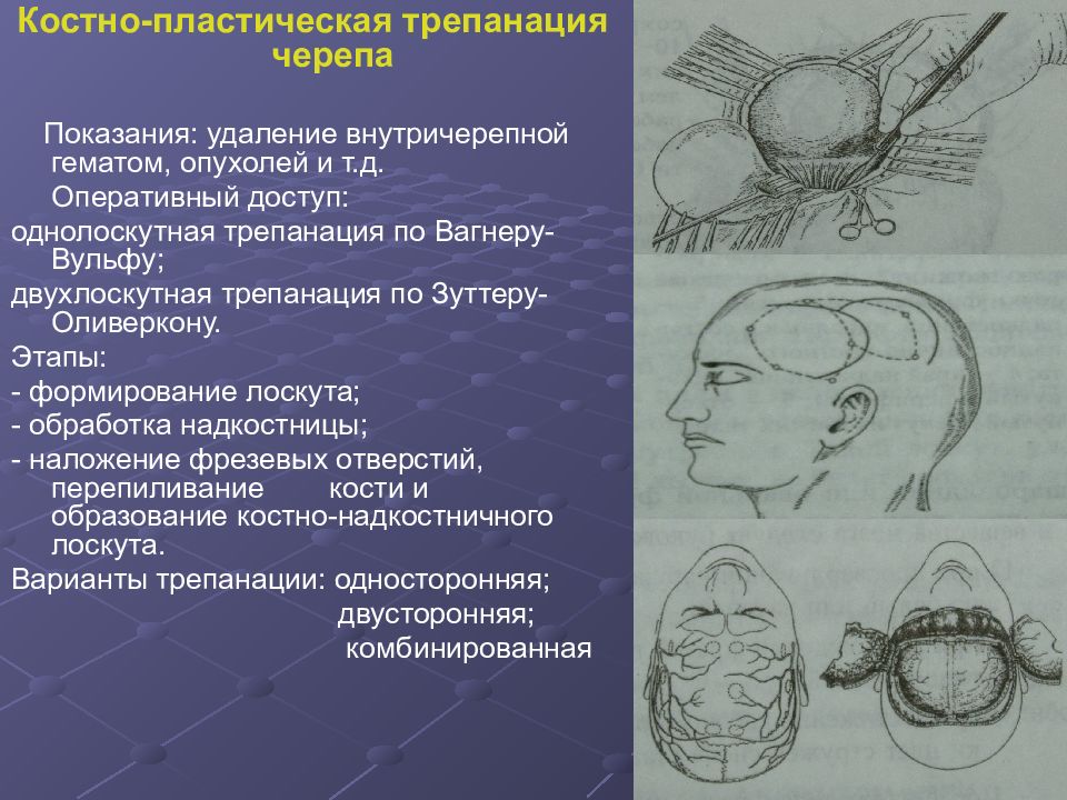 Презентации по топографической анатомии