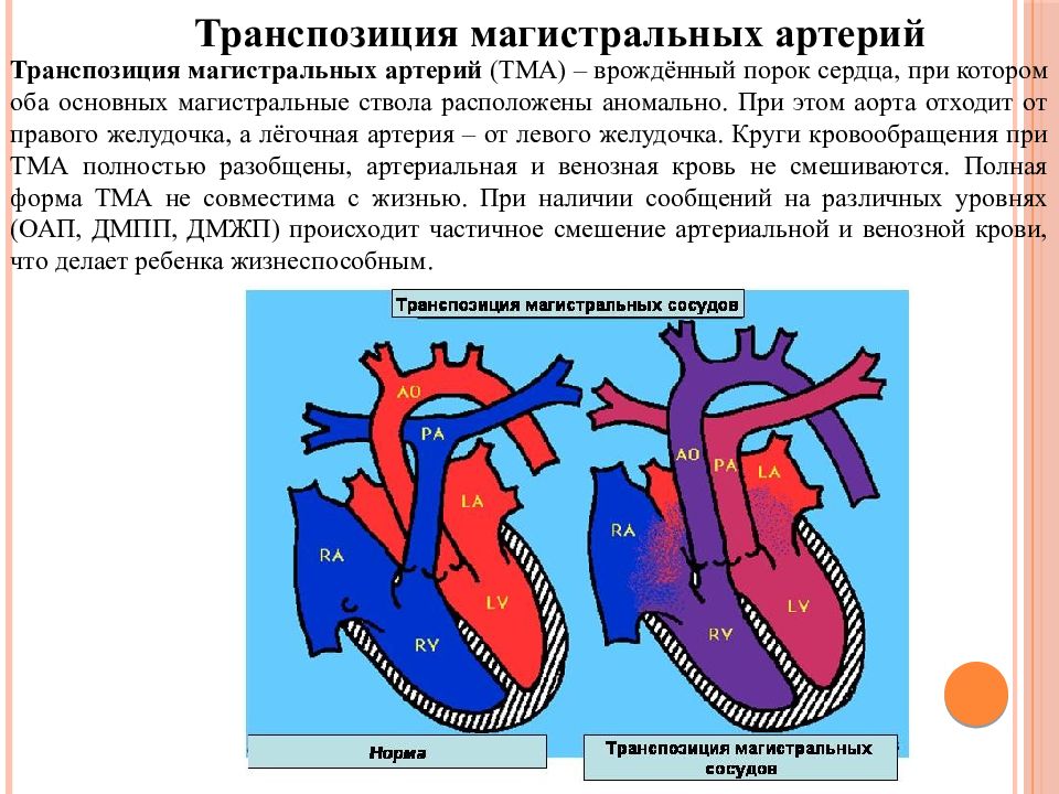 Магистральные сосуды. Транспозиция магистральных сосудов гемодинамика схема. Гемодинамика при врожденных пороках сердца схема. Полная транспозиция магистральных сосудов гемодинамика. Полная транспозиция магистральных сосудов схема.