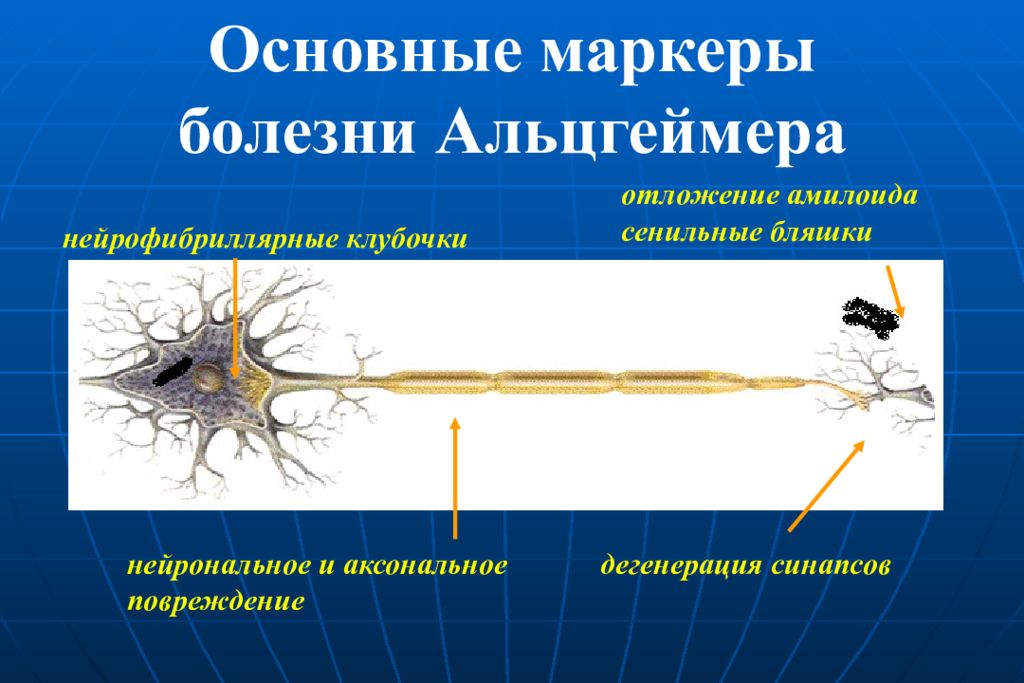 Дегенерации нерва