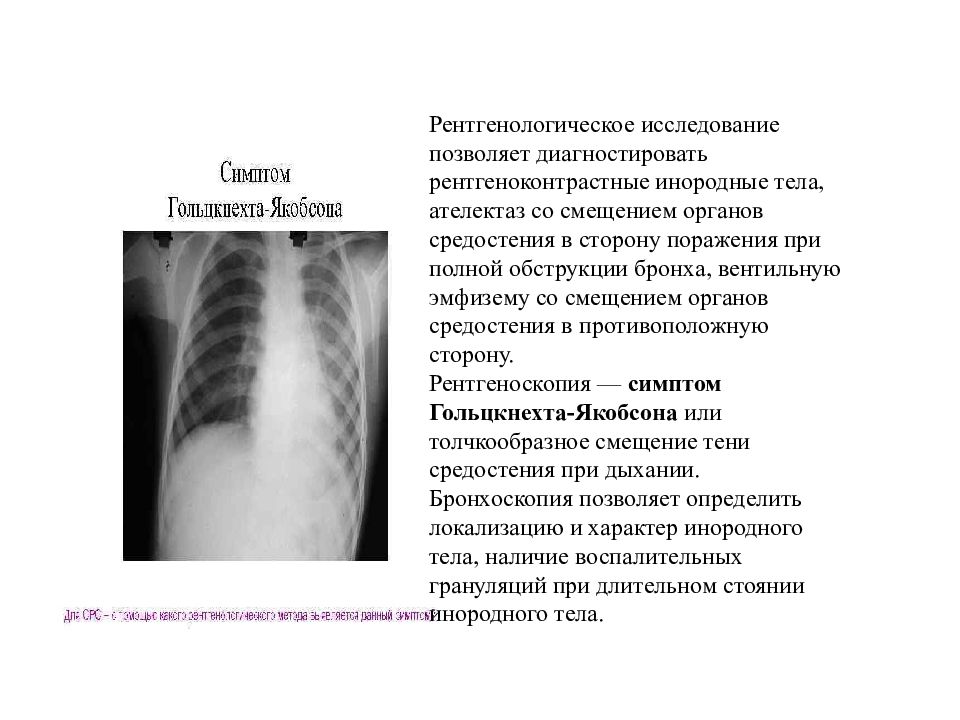 Инородное тело трахеи карта вызова