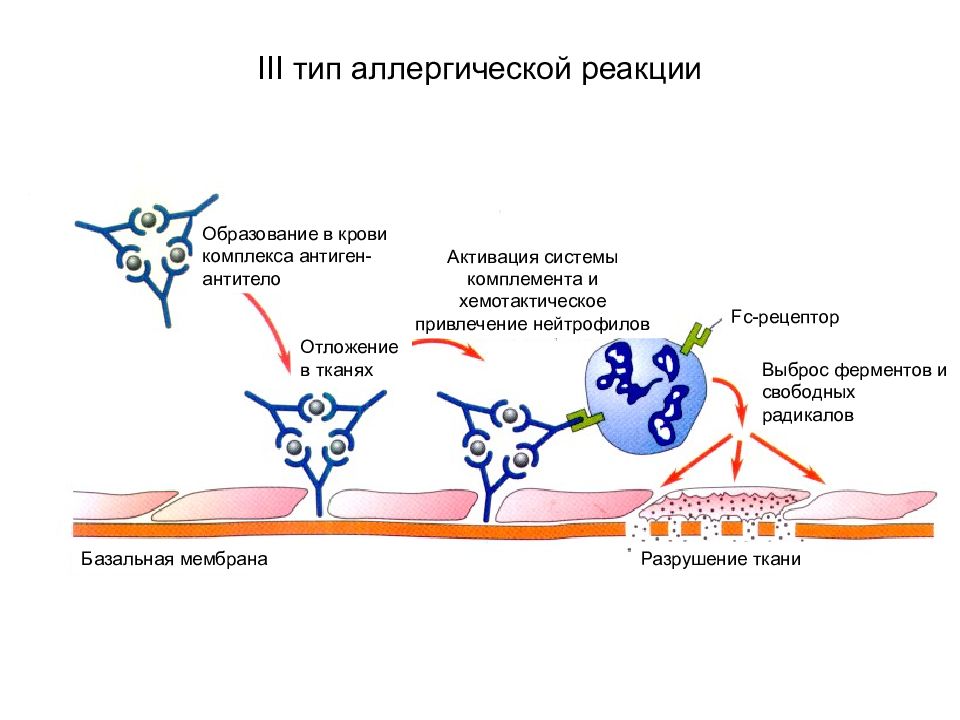 Третий тип. Схема аллергической реакции 3 типа. 3 Тип аллергической реакции. Аллергическая реакция 3 типа патофизиология. Иммунокомплексный Тип аллергической реакции схема.