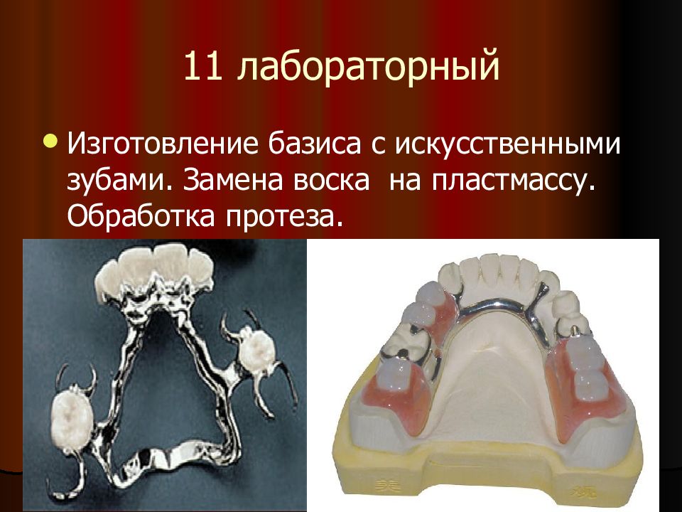 Этапы изготовления бюгельных протезов презентация