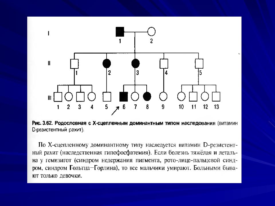 Типы родословных. Х сцепленный доминантный Тип наследования. X доминантный Тип наследования родословная. X сцепленный доминантный Тип наследования родословная. Критерии х сцепленного доминантного типа наследования.