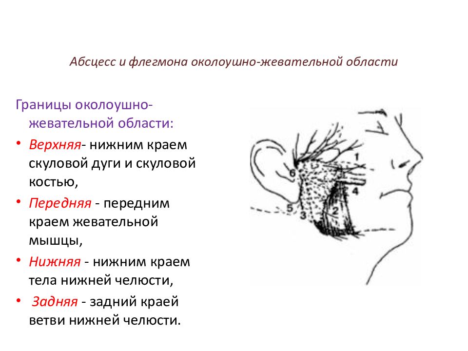 Абсцесс и флегмона. Техника вскрытия флегмоны околоушно-жевательной области.. Абсцесс и флегмона околоушно-жевательной области. Осложнения при дренировании флегмоны околоушно-жевательной области. Флегмон абсцессов флегмон.