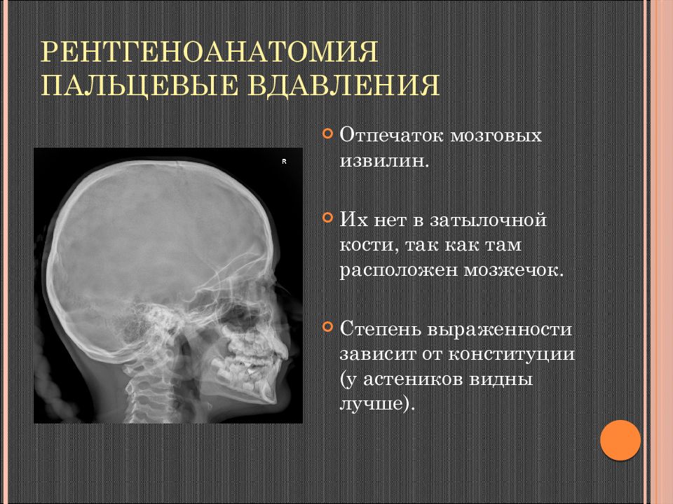 На рентгене черепа усиление сосудистого рисунка