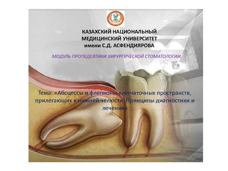 КАЗАХСКИЙ НАЦИОНАЛЬНЫЙ МЕДИЦИНСКИЙ УНИВЕРСИТЕТ имени С.Д. АСФЕНДИЯРОВА Тема: