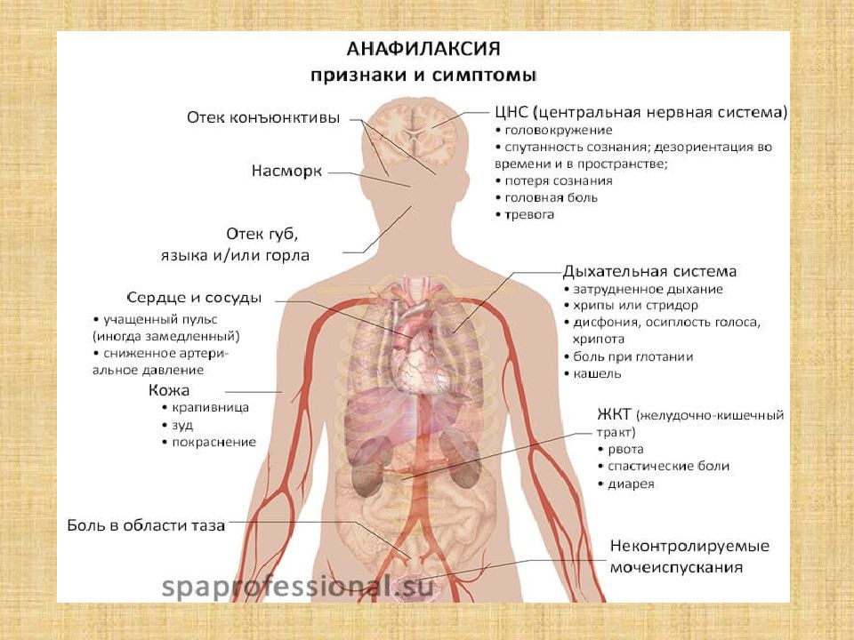 Анафилаксия рекомендации. Анафилаксия презентация.