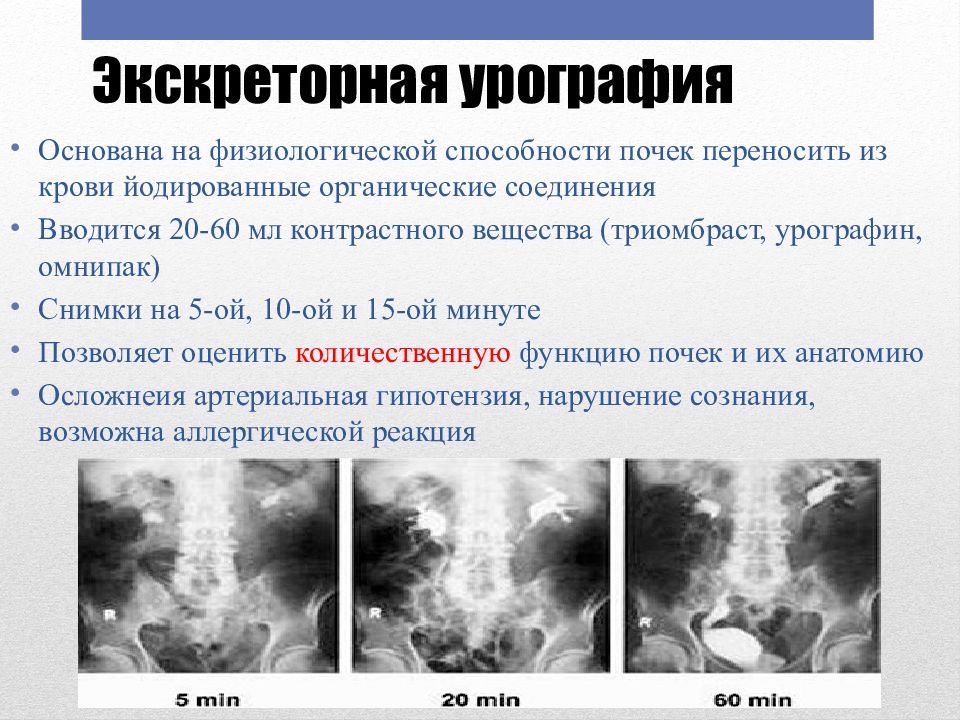 Урография Вен Плвого Члена