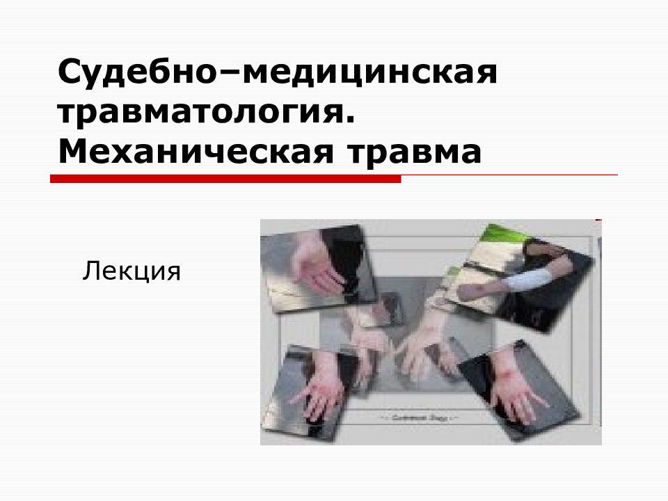 Судебно–медицинская травматология. Механическая травма