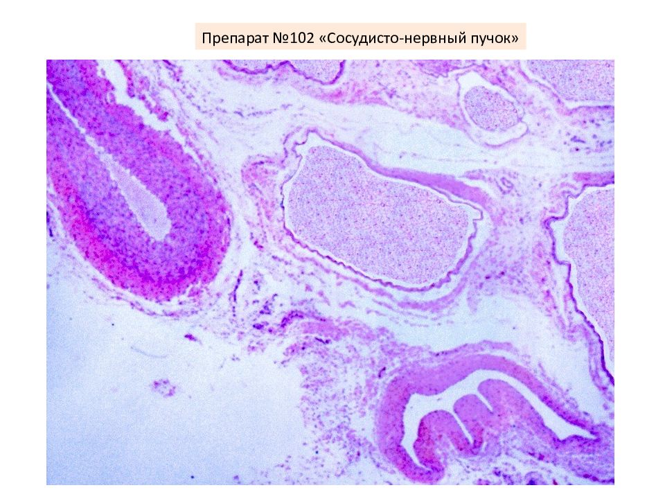 Сосудисто нервный пучок. Нервно сосудистый пучок гистология препарат. Сосудисто нервный пучок гистология препарат. Нервный пучок гистология препарат. Артерия и Вена гистология препарат.