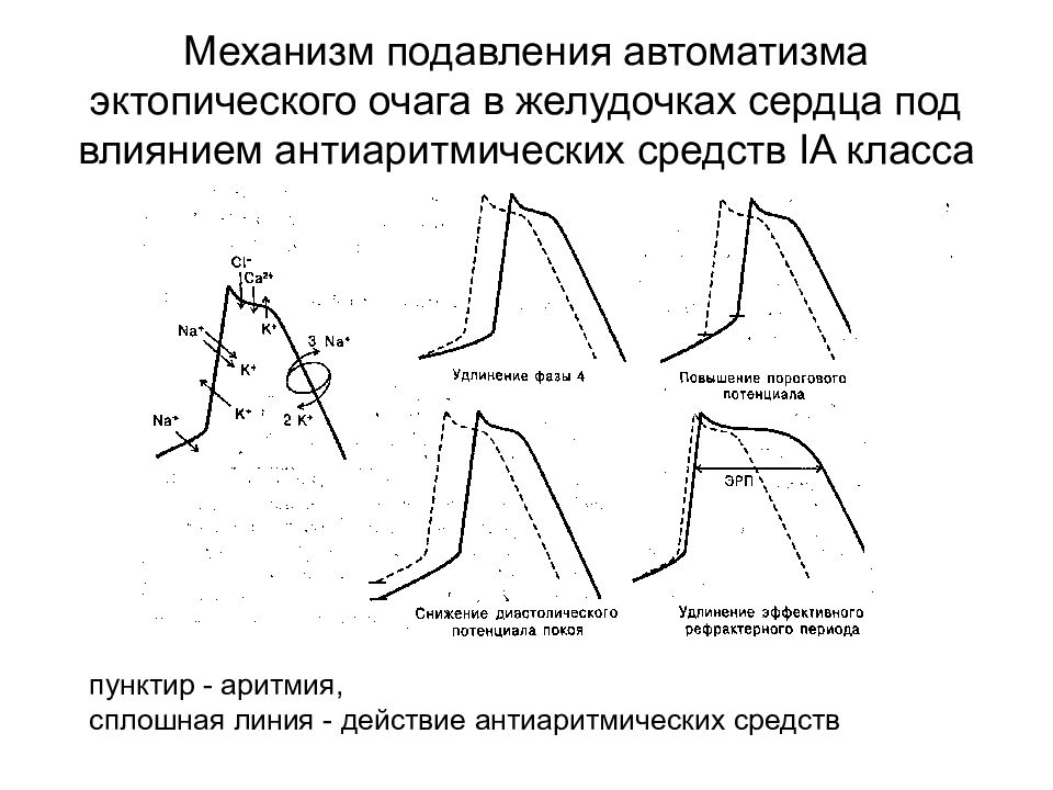 Механизм действия антиаритмических препаратов. Механизм действия антиаритмических средств. Влияние антиаритмических препаратов на потенциал действия. Антиаритмические препараты 1 класса механизм действия. Механизм действия 2 класса антиаритмических средств.