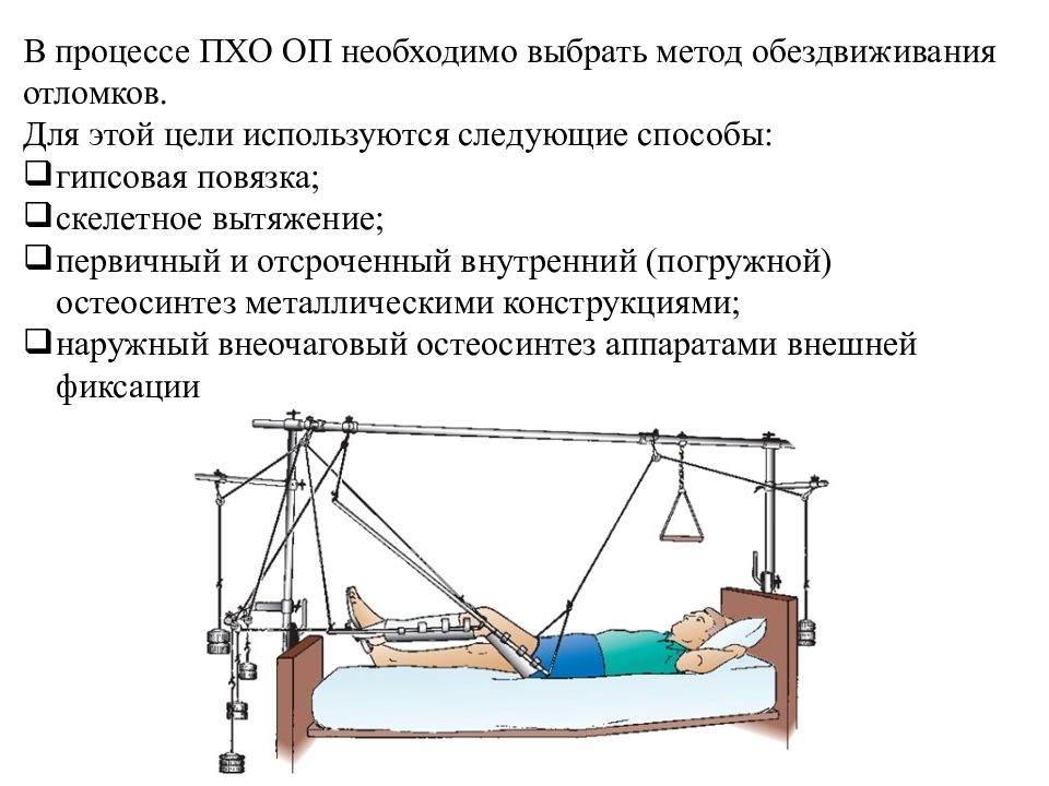 Оп это. Металлоконструкции для проведения скелетного вытяжения. Пхо открытых переломов. Пхо при открытых переломах. Величина груза при скелетном вытяжении.