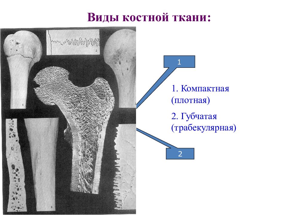 Типы костной ткани. Разновидности костной ткани. Введение в костную ткань. Типы костей челюсти. Участки губчатой костной ткани.