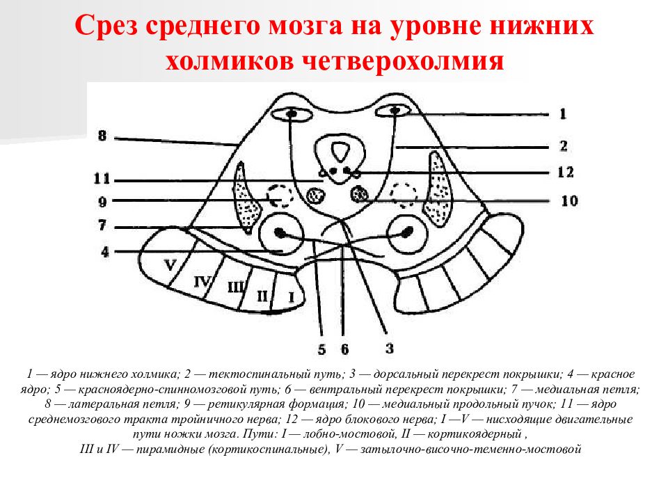 Уровни мозга. Схема поперечного разреза среднего мозга. Поперечный срез среднего мозга схема. Поперечный срез среднего мозга ядра. Схема внутреннего строения среднего мозга.