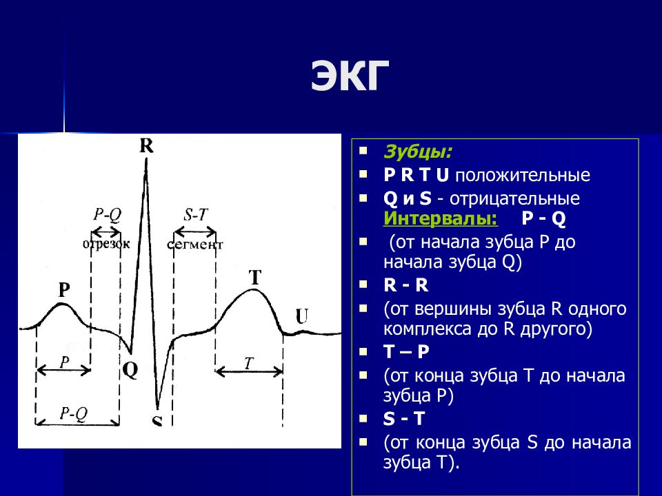 Основы экг презентация