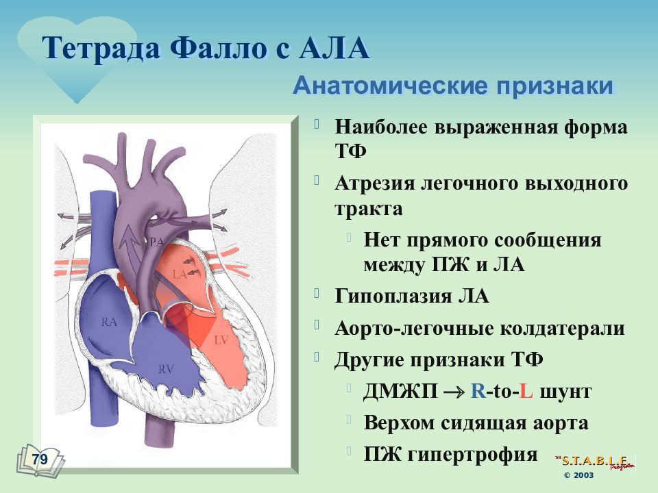 Тетрада фалло клиническая картина