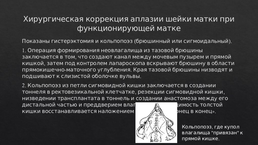 Аплазия это в медицине. Формирование неовлагалища. Кольпопоэз из тазовой брюшины. Аплазия матки и влагалища. Аномалии развития половых органов у мальчиков.