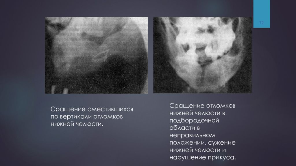 Лучевое исследование челюстно лицевой зоны презентация