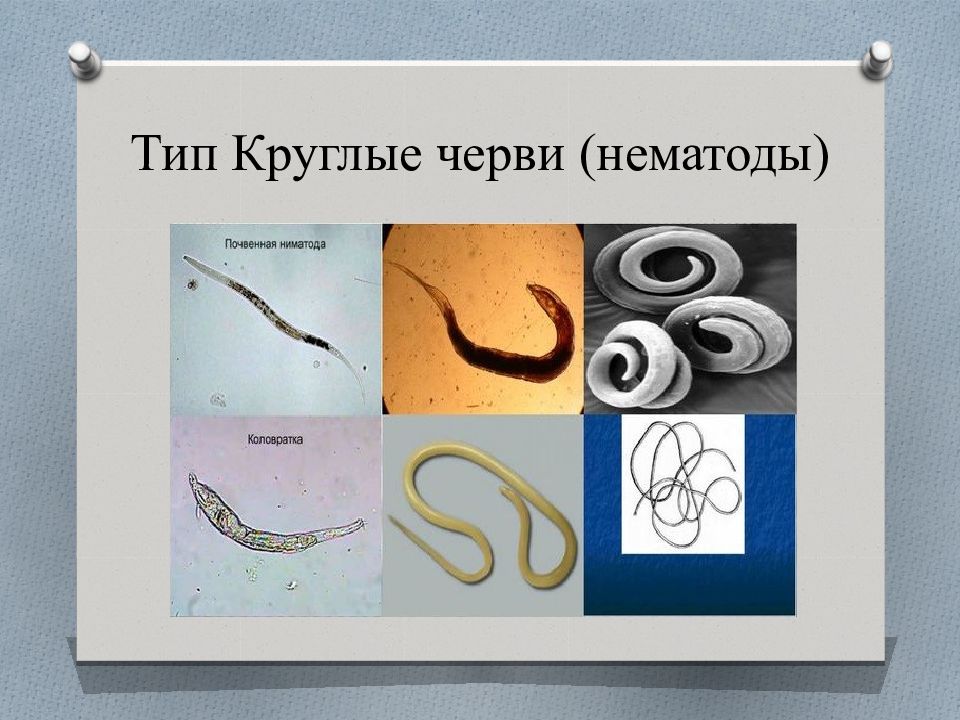 Круглые черви примеры названия. Круглые черви класс нематоды. 4 Валика круглых червей. Тип круглые черви нематоды. Нематоды представители.