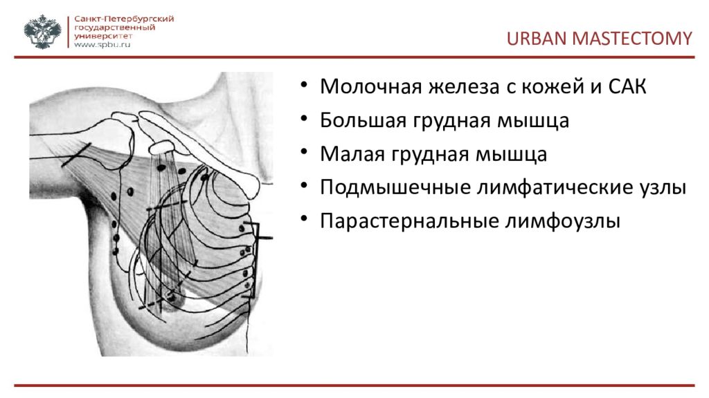 Лимфоузлы при рмж. Парастернальные лимфатические узлы. Подмышечные лимфатические узлы. Лимфатические узлы молочной железы. Лимфатические узлы груди онкология.
