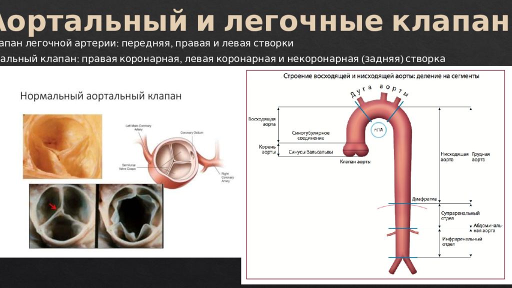 Клапан аорты створки уплотнены