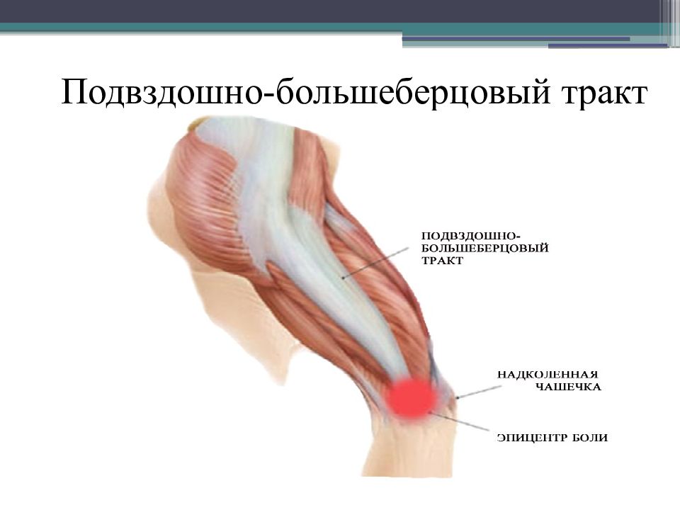 Подвздошно большеберцовый тракт. Воспаление подвздошно-большеберцового тракта. Тендинопатия подвздошно-большеберцовый тракт. Большеберцовый тракт анатомия. Подвздошно большеберц тракт.